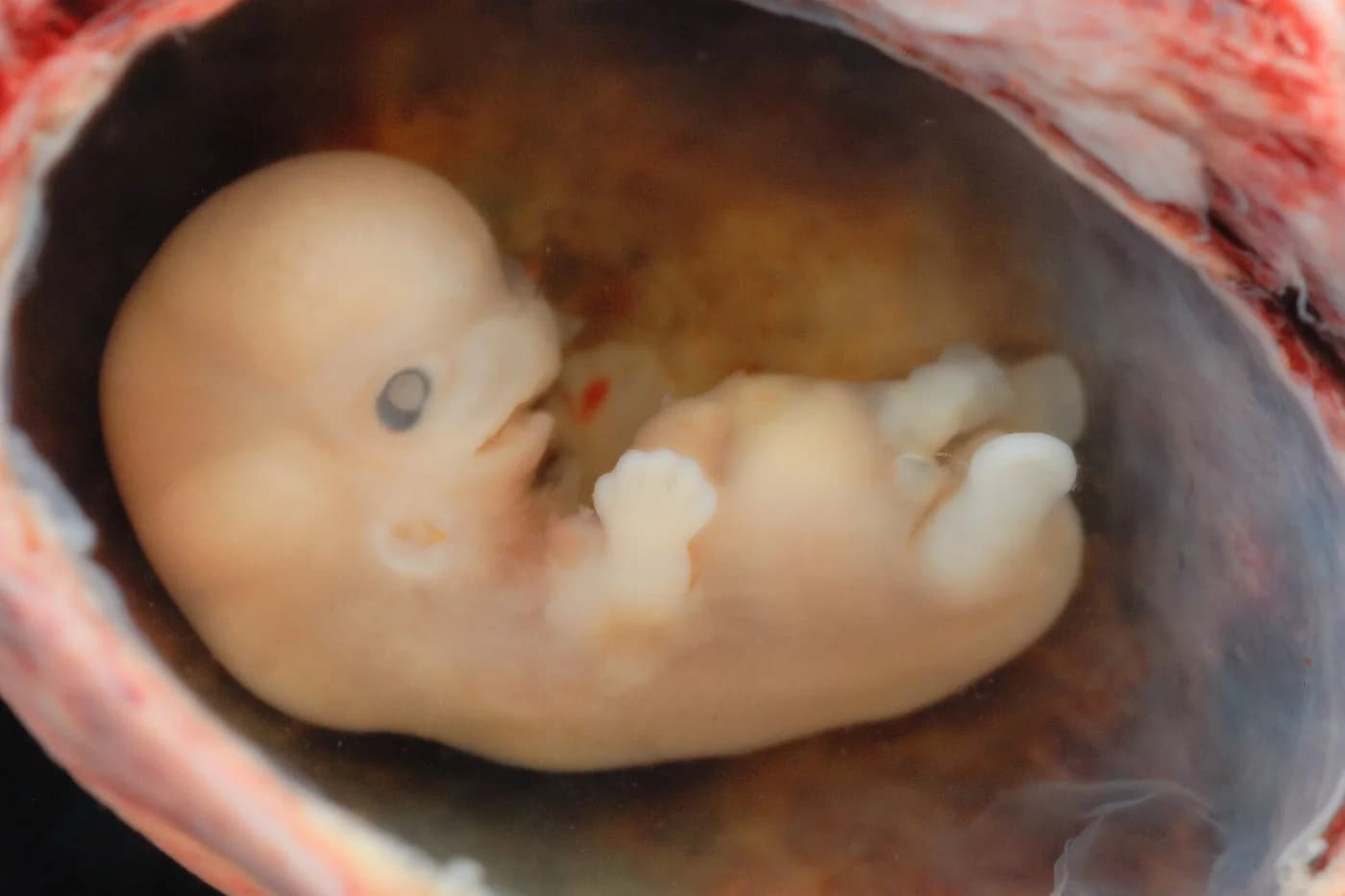 Embryo van ongeveer 8 weken in de vruchtzak, met oogje, handjes en voetjes